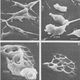 Illustration for article titled Brain-eating amoebas claim the life of a teenager in Florida